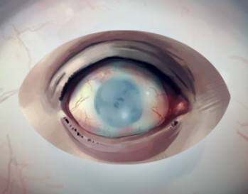 Elite Gaming Token (5 Pack) - Blind